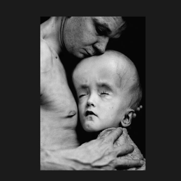 Chernobyl Lies, Cover-Up WHO